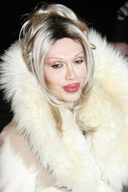 Pete Burns